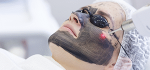 Radiofrequency Facial
