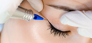 Tranexamic Pigment Peel