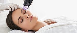 Intimate Whitening Peel